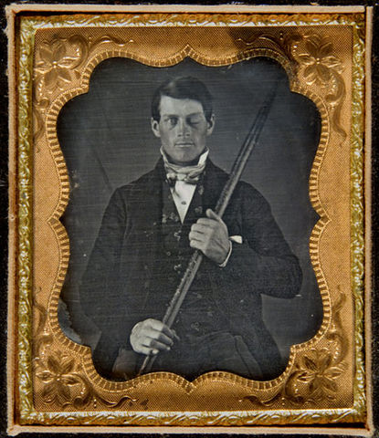 Neuroscienze Phineas Gage